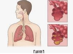  폐렴 예방접종 가격 및 시기