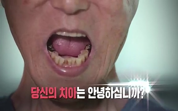 [792회] 생로병사의 비밀 - KBS[세균의 습격, 당신의 잇몸을 지켜라!] 감기보다 병원을 더 자주 찾게 만드는 질병이 있다. 바로 치주질환이다. 2020년 외래 다빈도 질병 1위를 차지한 치은염 및 치주질환 환자는 1,637_20220505_141546.369.jpg