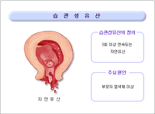 여성부인과-ㅡ유산의 종류, 원인, 증상, 치료방법.