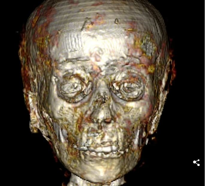 2&#44;300년 전 이집트 &#39;골든 보이&#39; 미이라의 해부 VIDEO: Meet the &#39;Golden Boy&#39; mummy