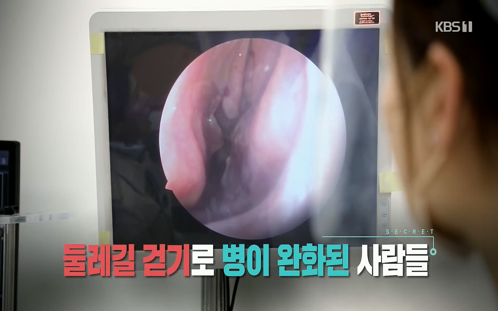 생로병사의 비밀.E816.220413p.H264-F1RST.mp4_20220414_192651.639.jpg