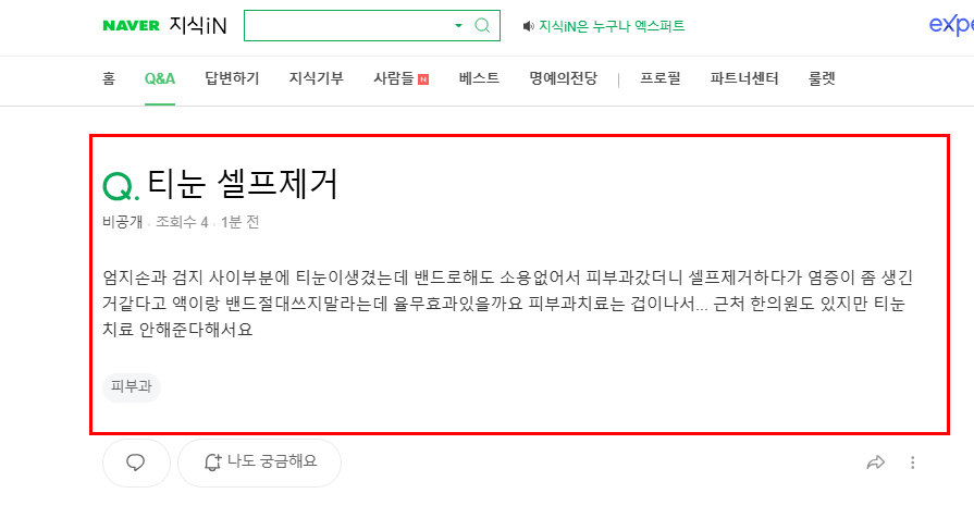 티눈 셀프제거 질문 지식인