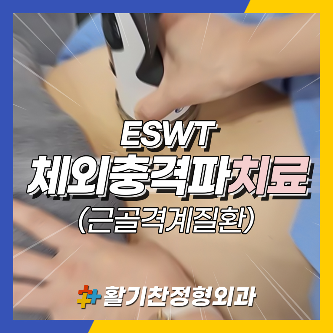  은평구 연신내역 근골격계질환에 좋은 ESWT 체외충격파치료