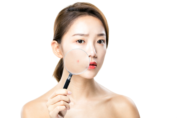  여드름 빨리 없애는법 총정리