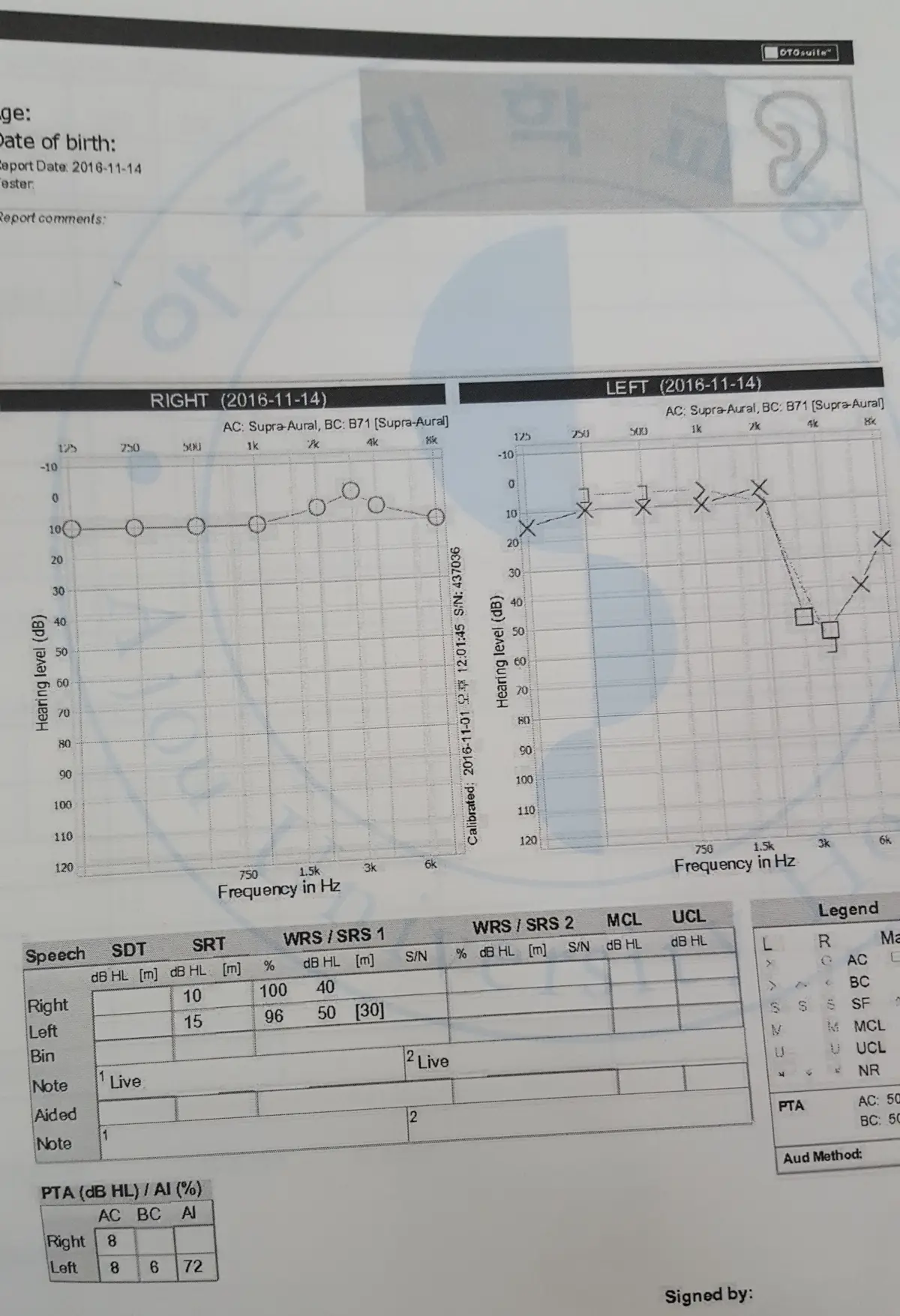 11월 14일 청력검사 결과지