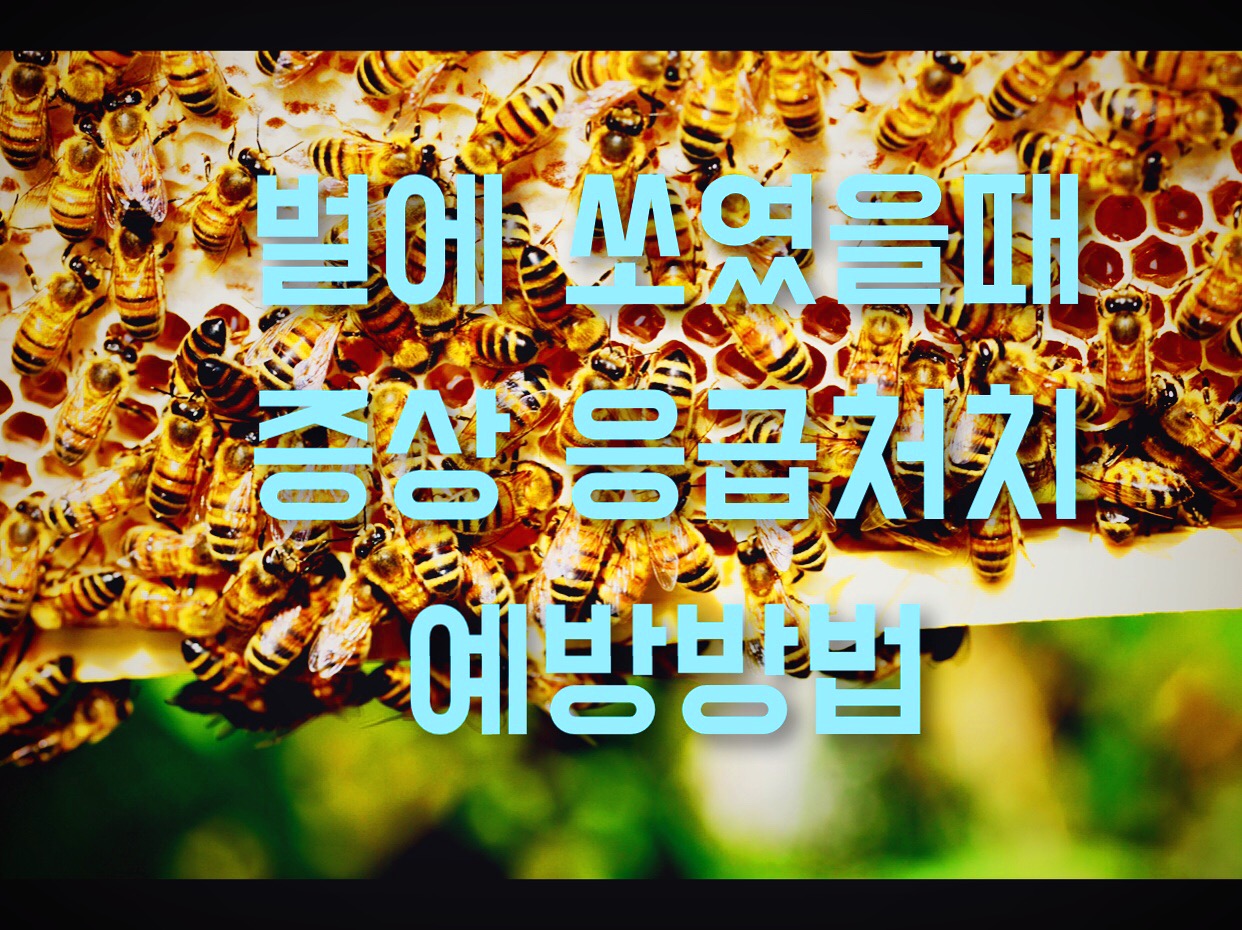  벌에 쏘였을때 증상 응급처치 그리고 예방방법