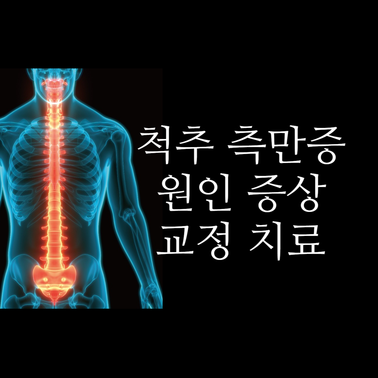  척추 측만증 원인 증상 교정 치료 방법