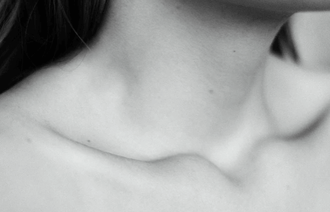 목 디스크 수술비용 neck image 6