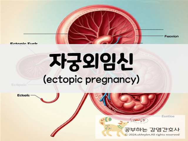 자궁외임신(ectopic pregnancy)의 원인 및 증상, 치료