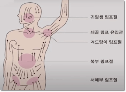 임파선부음