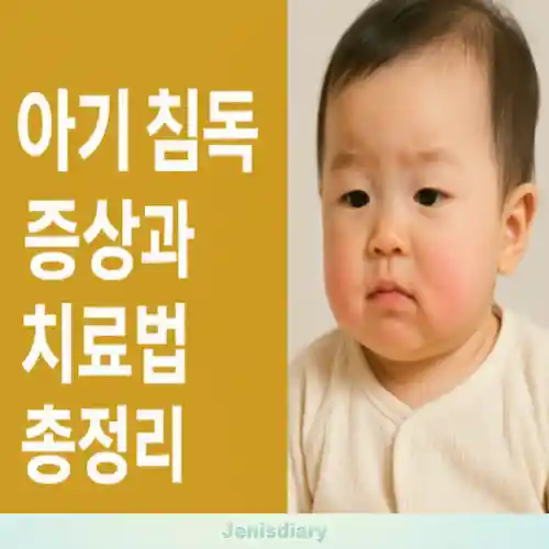 아기 침독 증상과 치료법 총정리 썸네일
