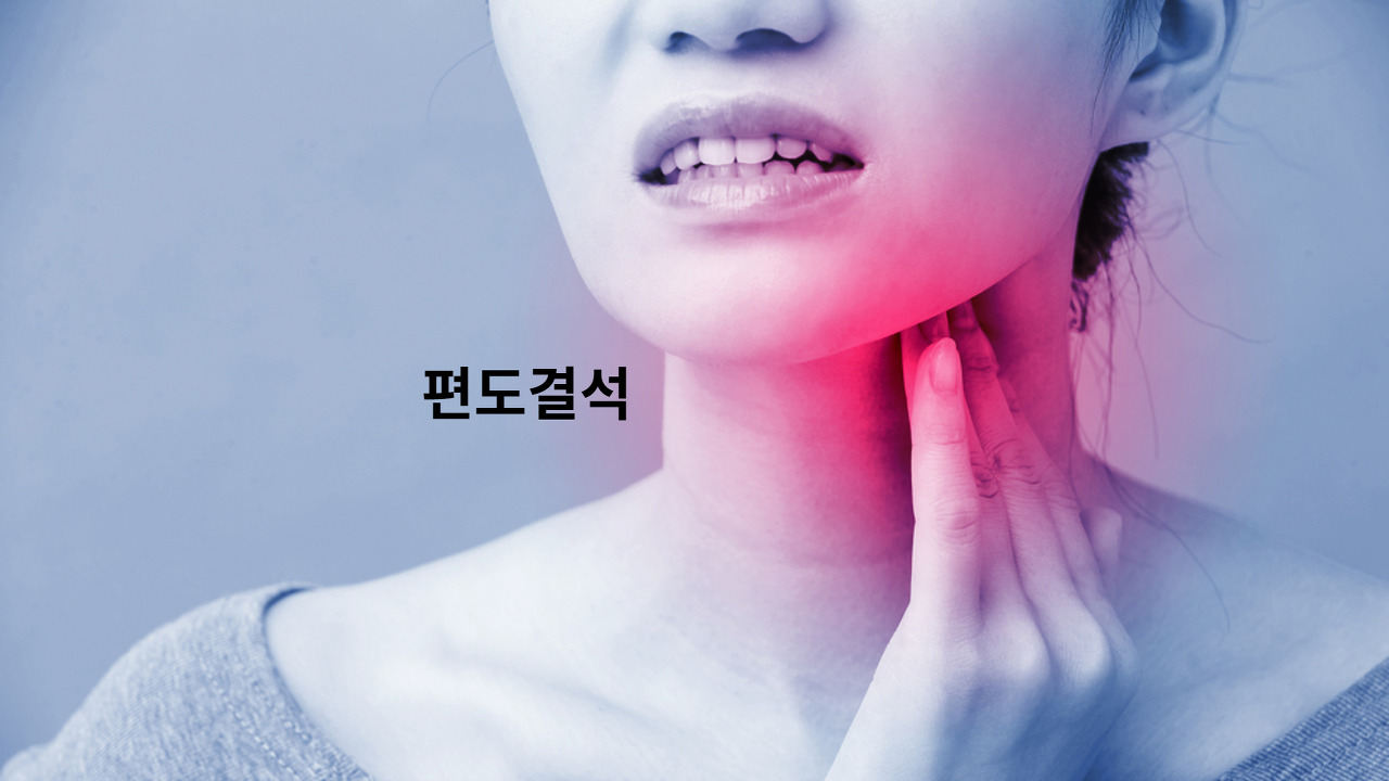 입 냄새 원인, 편도결석이란? 원인과 치료, 예방법을 확실하게 알려드립니다!