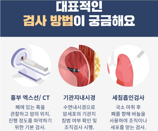 폐암 검사방법