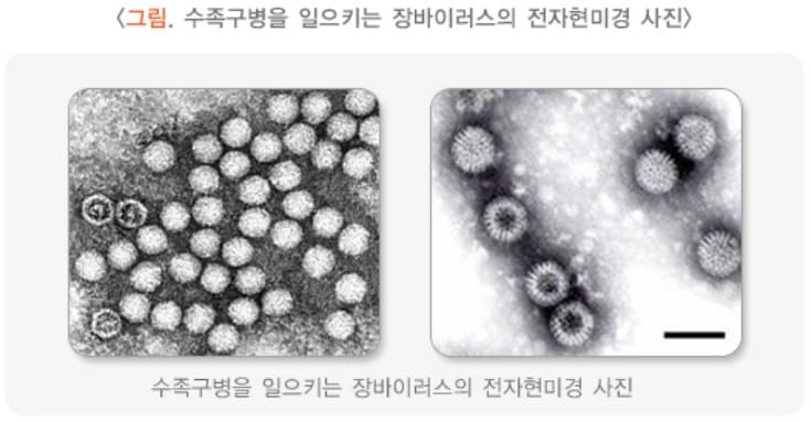 수족구병-원인-바이러스