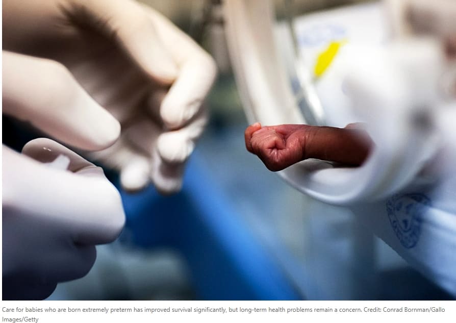 '인공자궁' 개발 동향...인간 실험 곧 착수...저출산 대책도 기대 VIDEO: Human trials of artificial wombs could start soon. Here’s what you need to know
