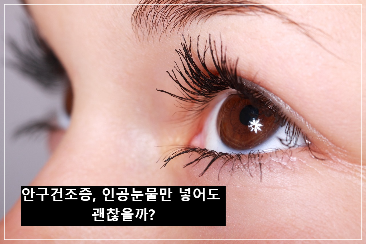 안구건조증, 인공눈물