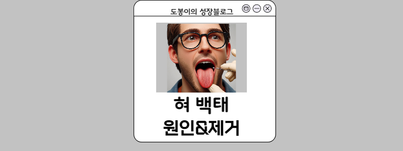  혀 백태는 왜 생기는 걸까? 원인과 예방,치료와 민간요법을 알아보자