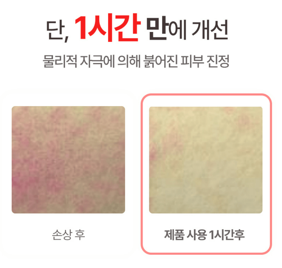 아토팜 MLE크림 아기 보습크림 추천