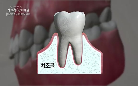 [792회] 생로병사의 비밀 - KBS[세균의 습격, 당신의 잇몸을 지켜라!] 감기보다 병원을 더 자주 찾게 만드는 질병이 있다. 바로 치주질환이다. 2020년 외래 다빈도 질병 1위를 차지한 치은염 및 치주질환 환자는 1,637_20220505_141549.777.jpg