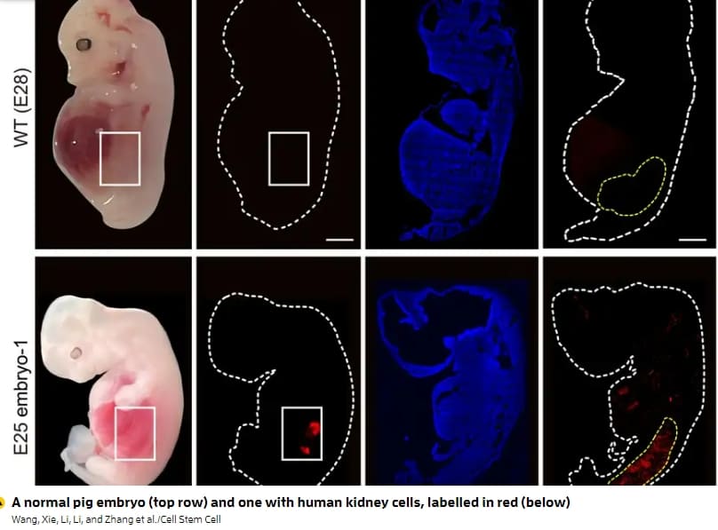 재생 불가능한 &#39;인간 신장&#39;&#44; 세계 최초 돼지 배아에서 자라 VIDEO: Human kidneys have been partially grown in pigs for the first time