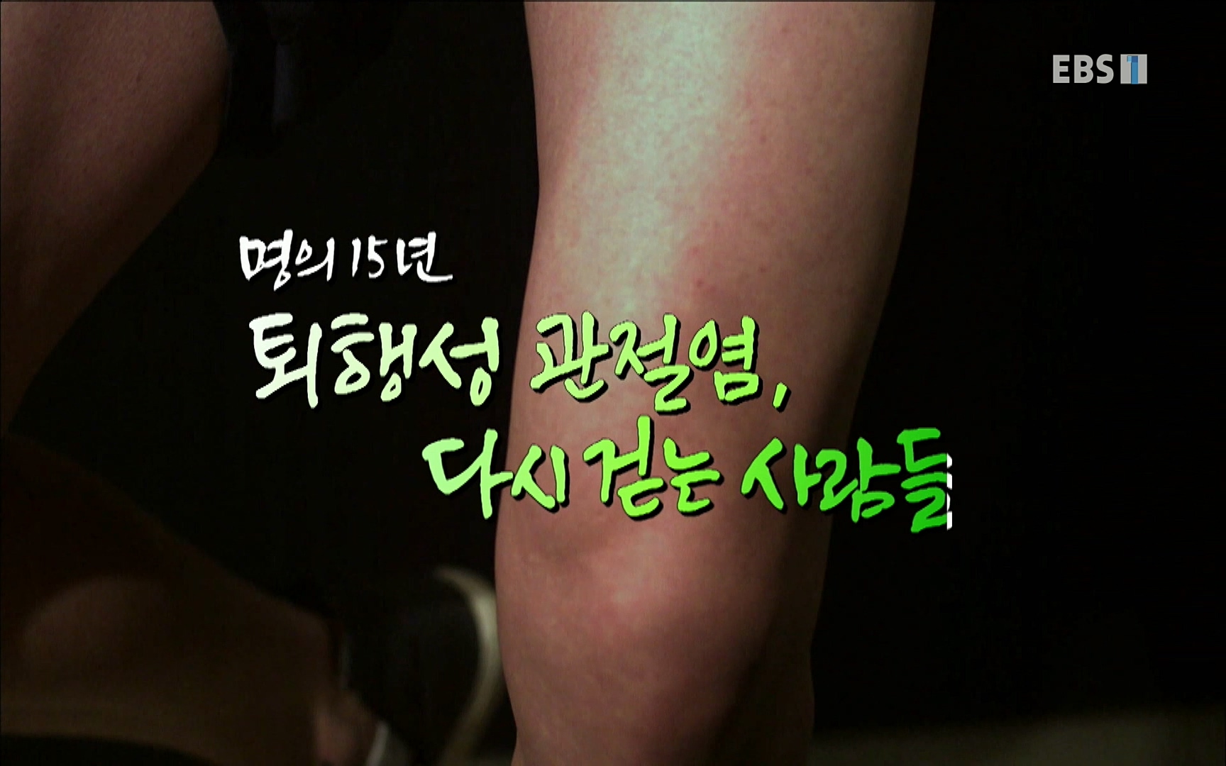 EBS 명의 헬스케어 - TV - 교육의 중심 EBS명의 15년 - 퇴행성관절염, 다시 걷는 사람들.mp4_20220803_205300.956.jpg