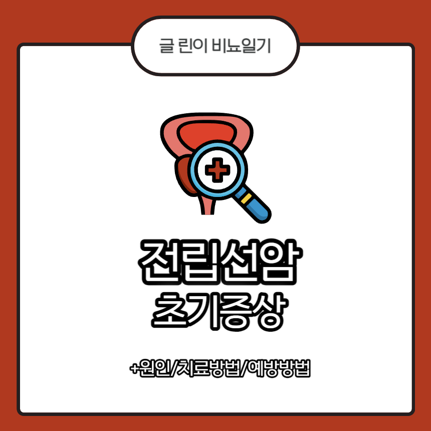  전립선암 초기증상 + 원인/치료방법/예방방법