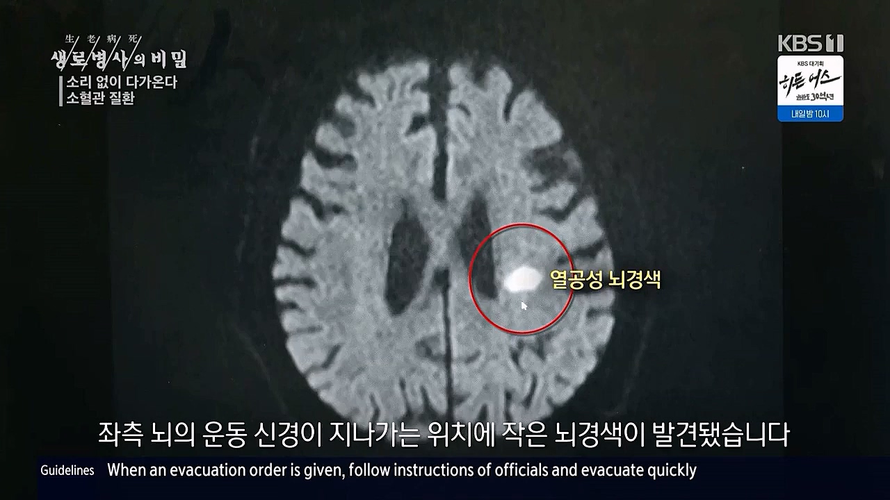 생로병사의비밀.E862.230309p.WANNA.mp4_20230309_194543.981.jpg