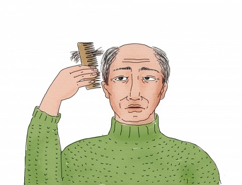  먹는 탈모약 바르는 탈모약 차이점