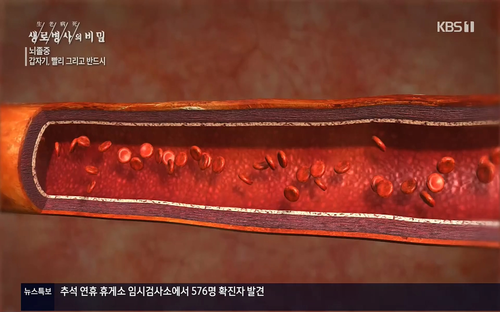 생로병사의 비밀.E835p.H264-F1RST.mp4_20220917_181746.980.jpg