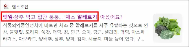 깻잎 알레르기 기사 이미지