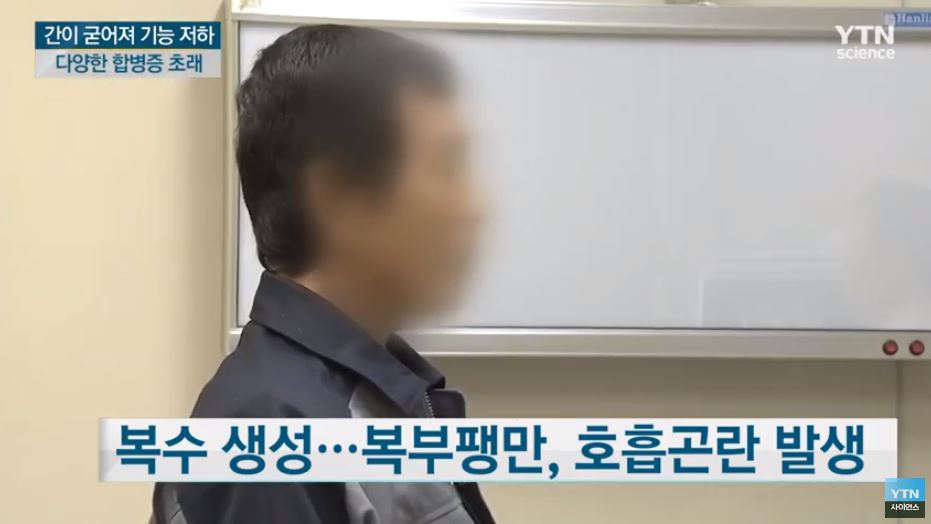  간경변(간경화) 자각증상  원인