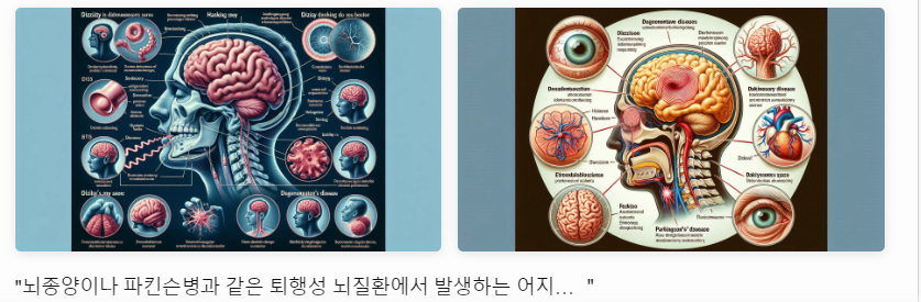 어지럼증의 원인 퇴행성 종양