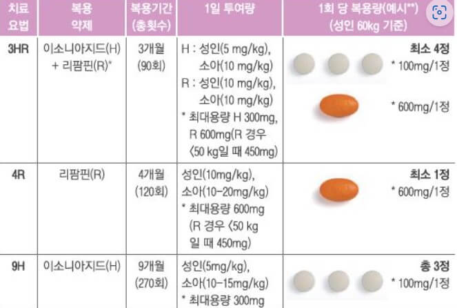 잠복결핵감염과 치료방법