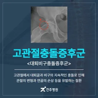 고관절 통증 증상 확인하기_11