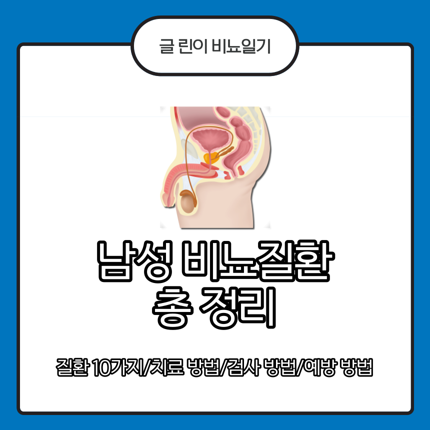  남성 비뇨질환 총 정리