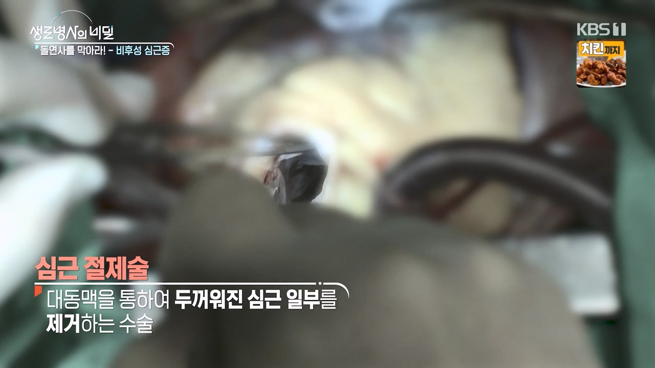 생로병사의 비밀.E912.240523p-NEXT.mp4_20240523_201951.550.jpg