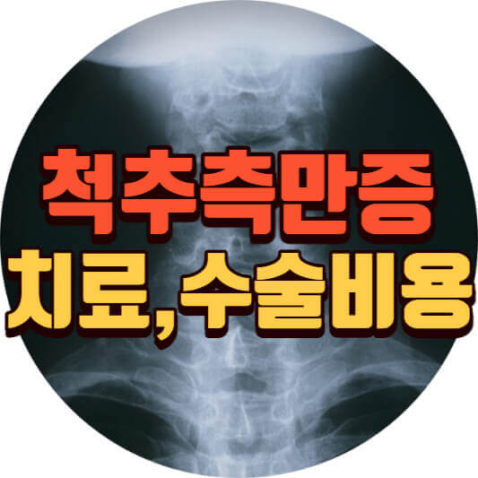  척추측만증 치료법, 수술비용 (feat.증상 원인)