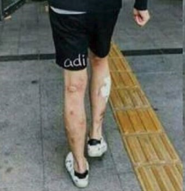  박유천다리, 메스버그 정체?
