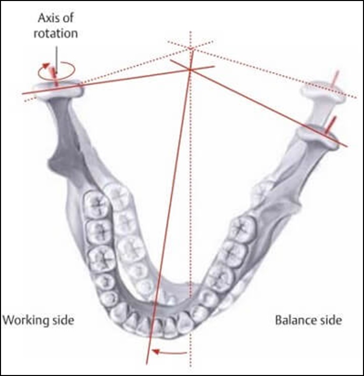 턱관절의 움직임을 나타낸 그림으로 한쪽으로 편측이동 한 경우를 나타낸 그림