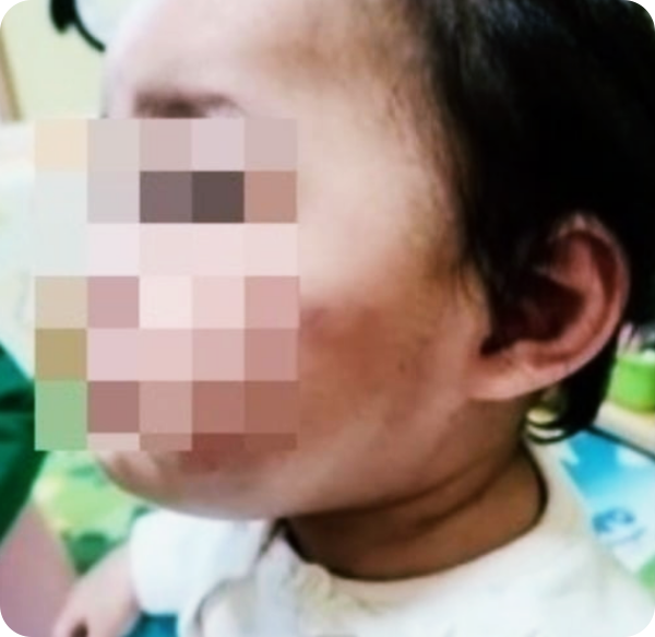  정인이 양부 직장서 만장일치로 해임...구내염 진단 소아과 원장 진실을 말하다!
