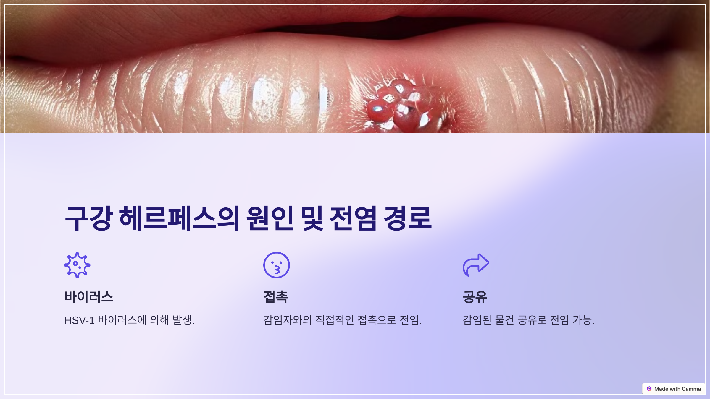 구강 헤르페스의 원인 및 전염 경로 🌡️