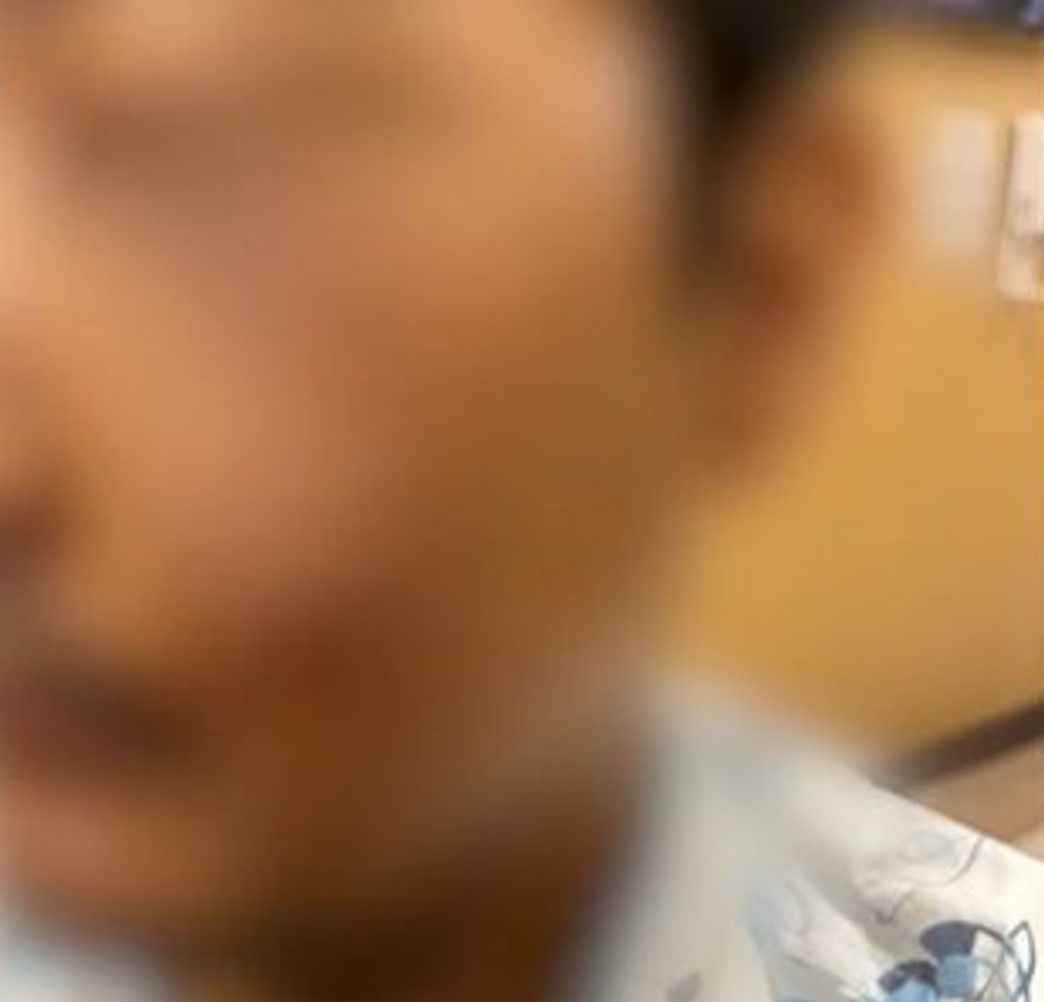 경기도 수원 인계동 10대 운전자 무차별 폭행 사건, 금속 무기 너클 주먹질, 피해자 실명