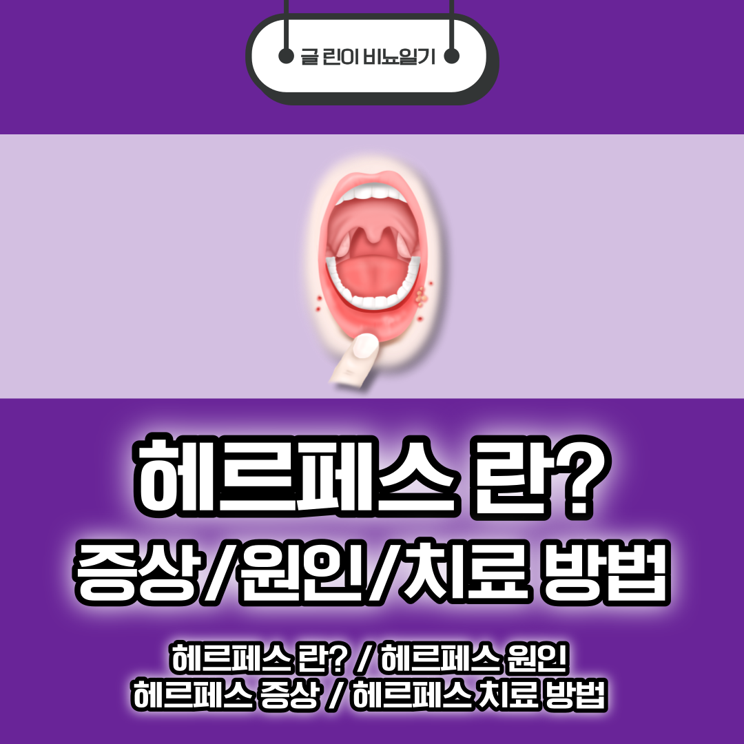  헤르페스 란? 증상 부터 원인 및 치료 방법 까지