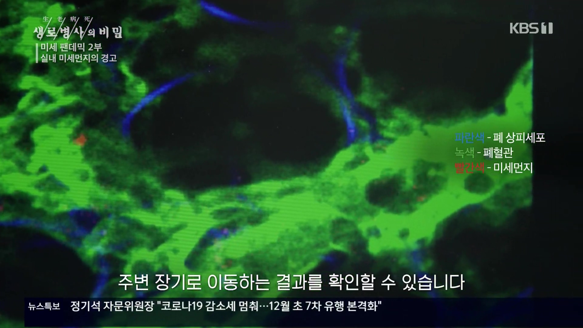 생로병사의 비밀.E840.221019p.H264-F1RST.mp4_20221020_175133.349.jpg