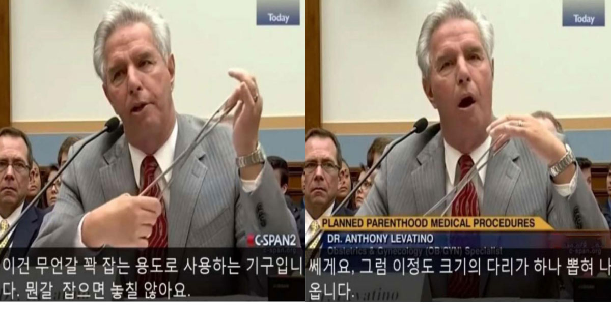  미국 의사가 말하는 낙태수술.jpg