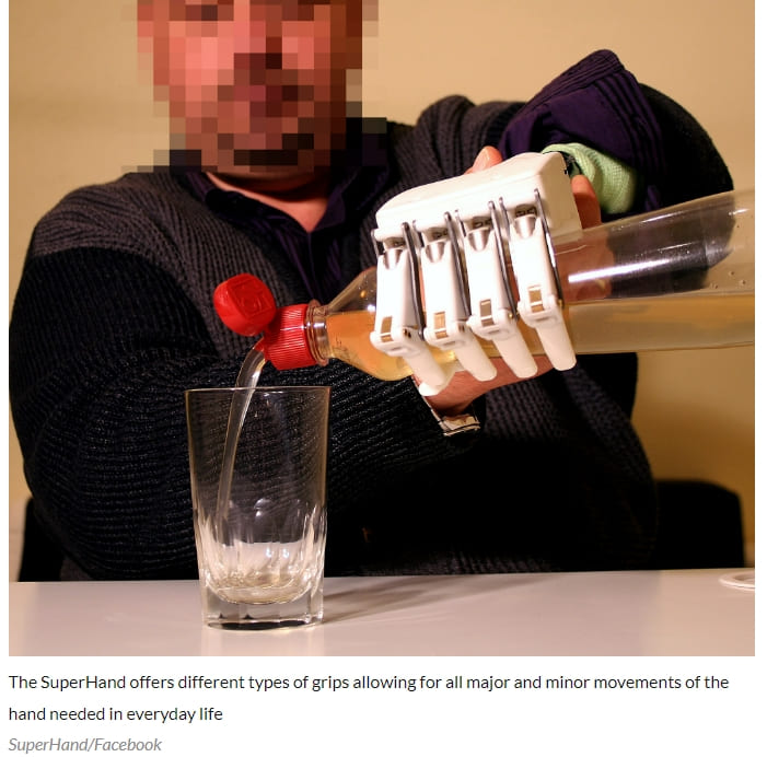 세계 최초 발로만 조종하는 생체 공학 팔 제작 World first: Wrocław scientists create bionic arm… steered by feet