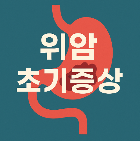 위암 초기증상