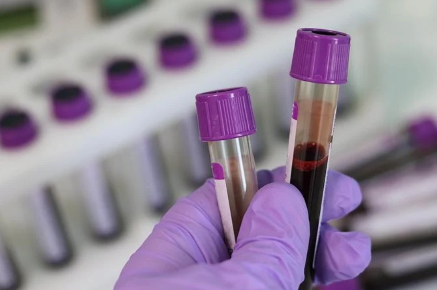 보건소, 의료기술직 공무원 취업, 임상병리사 취업 - 4