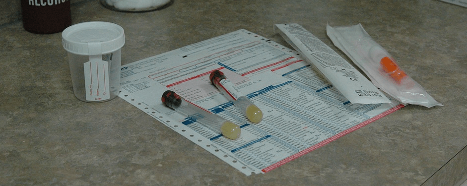 피검사 소변검사 샘플이 테이블 위에 놓여 있다