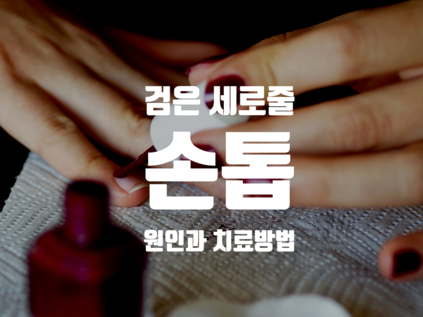  손톱 검은 세로줄 - 지금 바로 원인과 치료방법 알아보세요